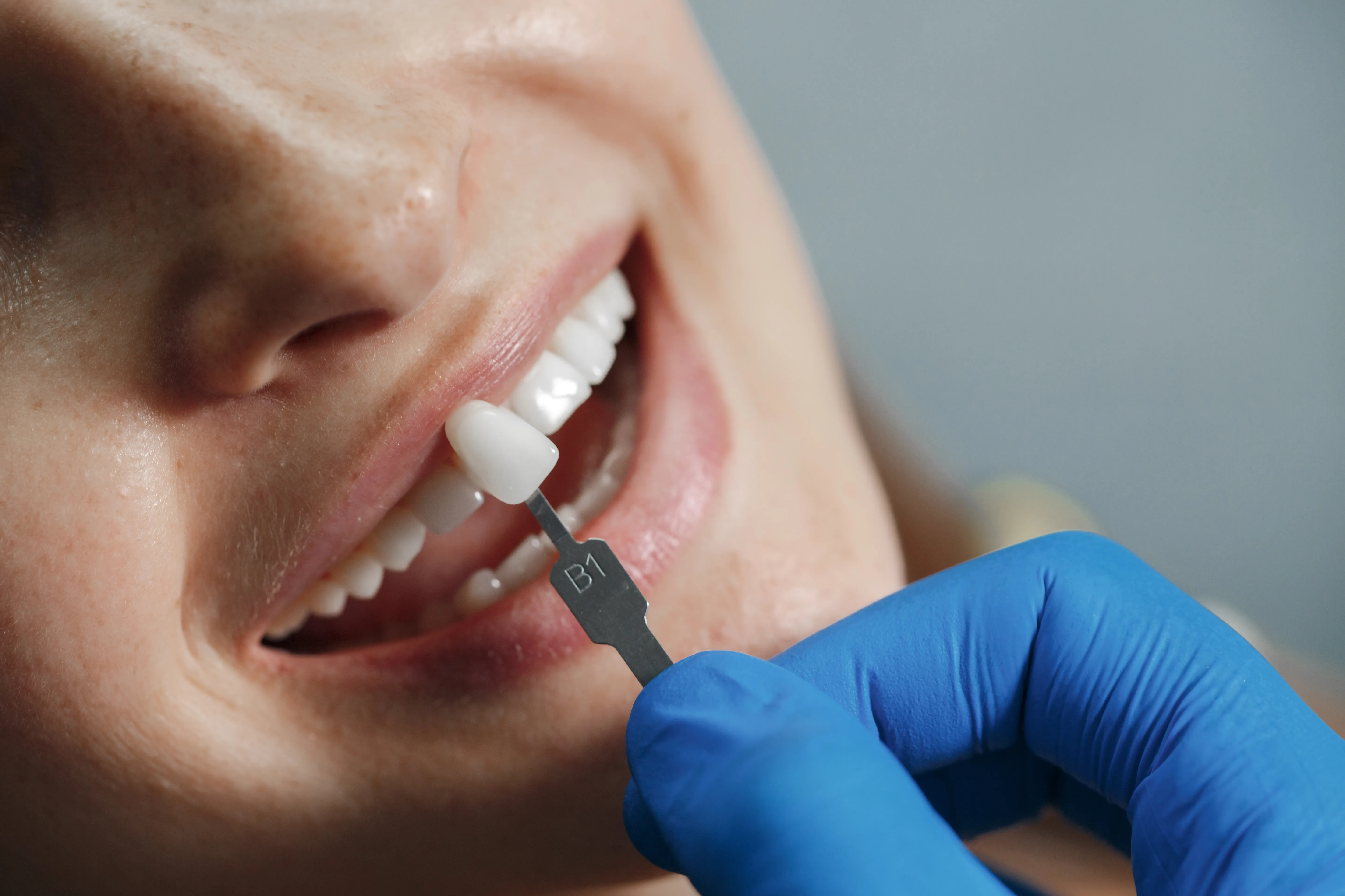 Transform Your Smile with Cosmetic Dentistry